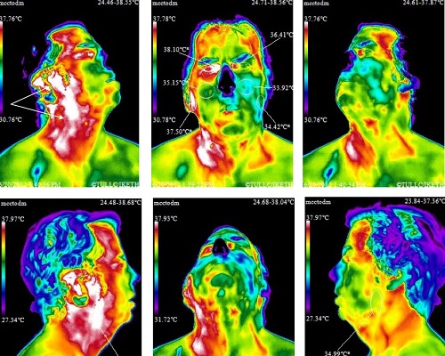 Cell Phone Face Radiation Map Cell Phone Face Radiation Map